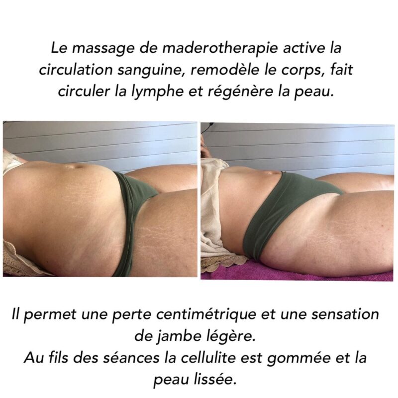 massage minceur